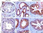 HOXA11 Antibody in Immunohistochemistry (IHC)