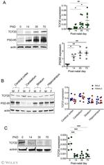 TCF20 Antibody in Western Blot (WB)