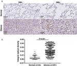 ZMYM6NB Antibody in Immunohistochemistry (Paraffin) (IHC (P))