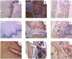 NFIX Antibody in Immunohistochemistry (Paraffin) (IHC (P))