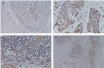 SIGLEC15 Antibody in Immunohistochemistry (Paraffin) (IHC (P))