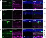 VIP Antibody in Immunohistochemistry (IHC)