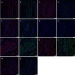 SOX2 Antibody in Immunocytochemistry (ICC/IF)