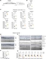 Neurocan Antibody in Western Blot (WB)