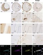 Biglycan Antibody in Immunohistochemistry (Paraffin) (IHC (P))
