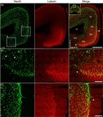 Latexin Antibody in Immunohistochemistry (IHC)