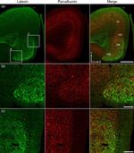 Latexin Antibody in Immunohistochemistry (IHC)