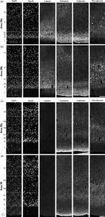 Latexin Antibody in Immunohistochemistry (IHC)