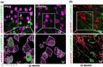 DARPP-32 Antibody in Immunohistochemistry - Free Floating (IHC (Free))