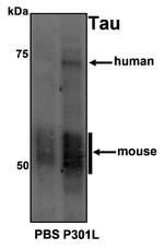 Tau Antibody in Western Blot (WB)