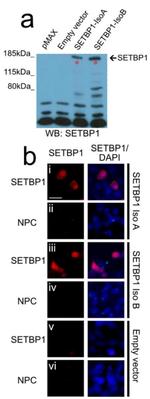 SETBP1 Antibody in Western Blot (WB)