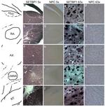 SETBP1 Antibody in Immunohistochemistry (IHC)