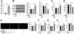 ASPH Antibody in Western Blot (WB)