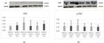 JNK1/JNK2/JNK3 Antibody in Western Blot (WB)