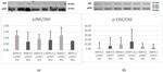 JNK1/JNK2/JNK3 Antibody in Western Blot (WB)