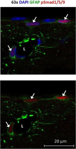 Rabbit IgG (Heavy chain) Secondary Antibody in Immunocytochemistry (ICC/IF)
