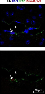Chicken IgY (H+L) Secondary Antibody in Immunocytochemistry (ICC/IF)