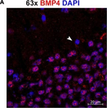 Rabbit IgG (Heavy chain) Secondary Antibody in Immunocytochemistry (ICC/IF)