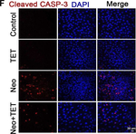 Rabbit IgG (H+L) Highly Cross-Adsorbed Secondary Antibody in Immunocytochemistry (ICC/IF)