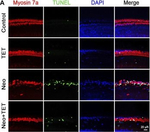 Rabbit IgG (H+L) Highly Cross-Adsorbed Secondary Antibody in Immunocytochemistry (ICC/IF)