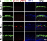 Rabbit IgG (H+L) Highly Cross-Adsorbed Secondary Antibody in Immunocytochemistry (ICC/IF)