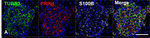 Chicken IgY (H+L) Cross-Adsorbed Secondary Antibody in Immunocytochemistry (ICC/IF)