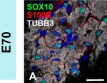 Rabbit IgG (H+L) Highly Cross-Adsorbed Secondary Antibody in Immunocytochemistry (ICC/IF)