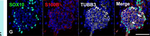 Mouse IgG2b Cross-Adsorbed Secondary Antibody in Immunocytochemistry (ICC/IF)