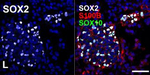 Mouse IgG1 Cross-Adsorbed Secondary Antibody in Immunocytochemistry (ICC/IF)