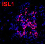 Rabbit IgG (H+L) Highly Cross-Adsorbed Secondary Antibody in Immunohistochemistry (Paraffin) (IHC (P))
