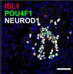 Rabbit IgG (H+L) Highly Cross-Adsorbed Secondary Antibody in Immunohistochemistry (Paraffin) (IHC (P))