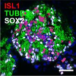 Rabbit IgG (H+L) Highly Cross-Adsorbed Secondary Antibody in Immunohistochemistry (Paraffin) (IHC (P))