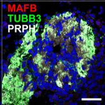 Rabbit IgG (H+L) Highly Cross-Adsorbed Secondary Antibody in Immunohistochemistry (Paraffin) (IHC (P))