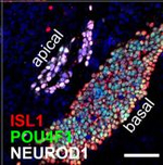 Rabbit IgG (H+L) Highly Cross-Adsorbed Secondary Antibody in Immunohistochemistry (Paraffin) (IHC (P))