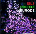 Rabbit IgG (H+L) Highly Cross-Adsorbed Secondary Antibody in Immunohistochemistry (Paraffin) (IHC (P))