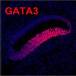 Rabbit IgG (H+L) Highly Cross-Adsorbed Secondary Antibody in Immunohistochemistry (Paraffin) (IHC (P))