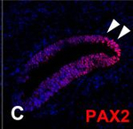 Rabbit IgG (H+L) Highly Cross-Adsorbed Secondary Antibody in Immunohistochemistry (Paraffin) (IHC (P))
