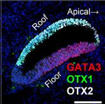 Rabbit IgG (H+L) Highly Cross-Adsorbed Secondary Antibody in Immunohistochemistry (Paraffin) (IHC (P))