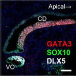 Rabbit IgG (H+L) Highly Cross-Adsorbed Secondary Antibody in Immunohistochemistry (Paraffin) (IHC (P))