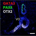 Rabbit IgG (H+L) Highly Cross-Adsorbed Secondary Antibody in Immunohistochemistry (Paraffin) (IHC (P))