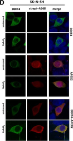 Rabbit IgG (Heavy chain) Secondary Antibody in Immunocytochemistry (ICC/IF)