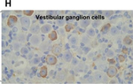 Mouse IgG Fc Secondary Antibody in Immunohistochemistry (Paraffin) (IHC (P))