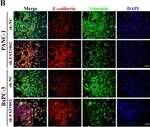 Rabbit IgG (H+L) Cross-Adsorbed Secondary Antibody in Immunocytochemistry (ICC/IF)
