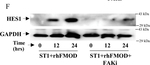 Rabbit IgG (H+L) Secondary Antibody in Western Blot (WB)