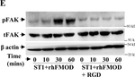 Rabbit IgG (H+L) Secondary Antibody in Western Blot (WB)