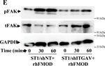 Rabbit IgG (H+L) Secondary Antibody in Western Blot (WB)
