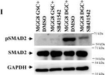 Rabbit IgG (H+L) Secondary Antibody in Western Blot (WB)