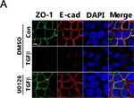 Rat IgG (H+L) Highly Cross-Adsorbed Secondary Antibody in Immunocytochemistry (ICC/IF)
