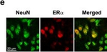 Rabbit IgG (H+L) Highly Cross-Adsorbed Secondary Antibody in Immunocytochemistry (ICC/IF)