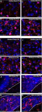 Rabbit IgG (H+L) Highly Cross-Adsorbed Secondary Antibody in Immunocytochemistry (ICC/IF)